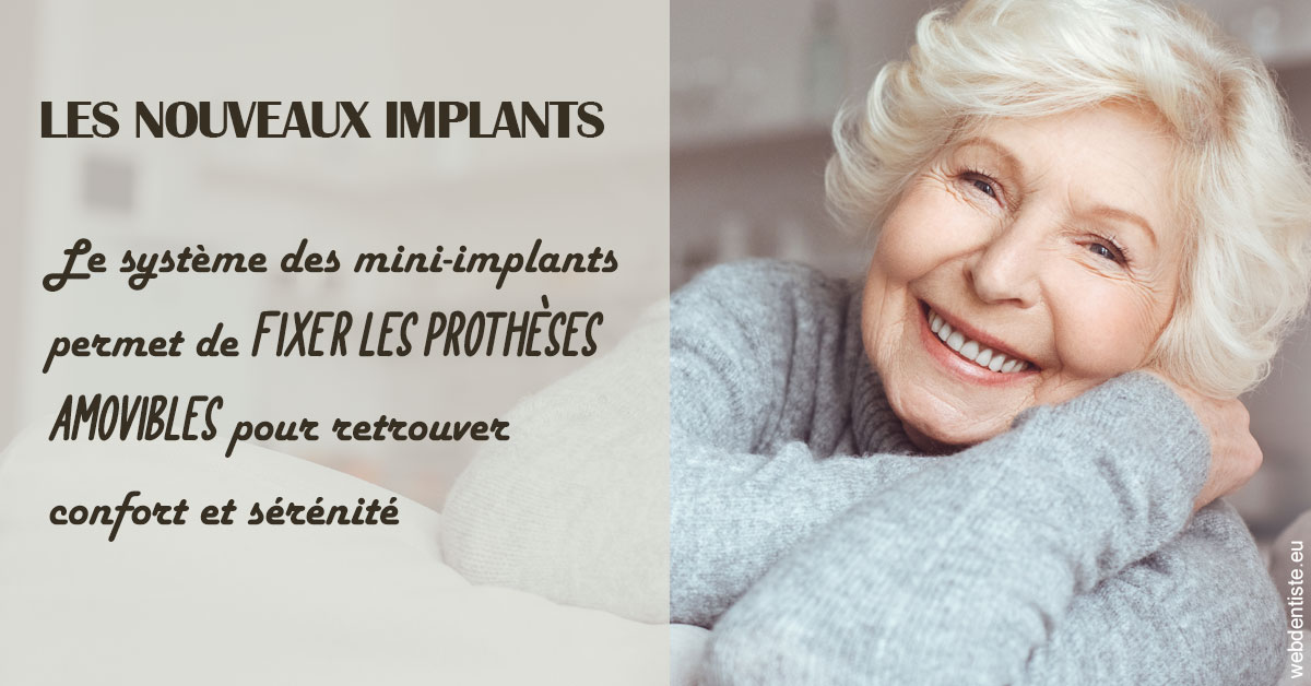 https://www.cabinet-orthodontie-oules.fr/Les nouveaux implants 1