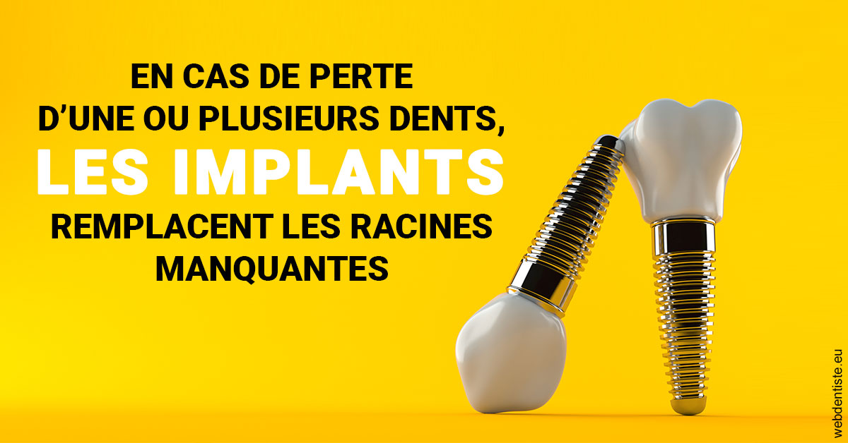 https://www.cabinet-orthodontie-oules.fr/Les implants 2
